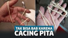 Tidak Bisa Buang Air Besar, Ternyata Ada Cacing Pita Sepanjang 9 Meter yang Menyumbat Dubur Pria Ini
