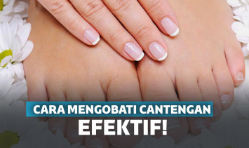 Cara mengobati cantengan