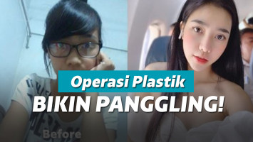 Perubahan setelah operasi plastik
