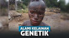 Ini Dia si Manusia Ular, Berganti Kulit Setiap Bulan dan Mandi Setiap Jam