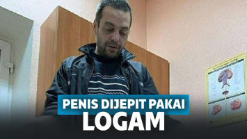 Ngilu! Dituduh Selingkuh, Penis Pria Ini Dipasangin Penjepit Logam oleh Istrinya hingga Bengkak