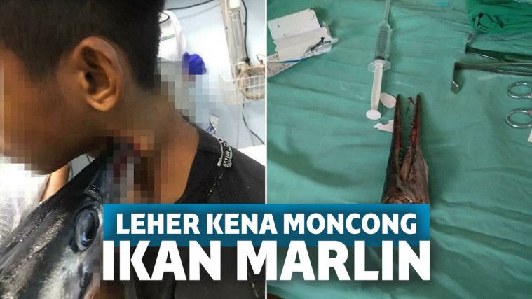  Leher  Remaja Ini Tertusuk Moncong Ikan  Marlin  Sedalam 15 Cm