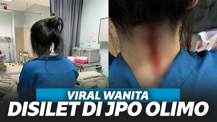 Viral Wanita Disilet Hingga Darah Mengucur di Halte Olimo Jakarta
