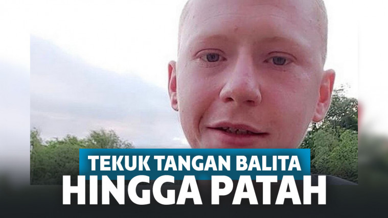 Terus Menangis, Pria Ini Tekuk Lengan Bayi 1 Tahun sampai Patah