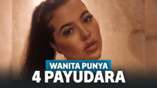 Tak Percaya Diri Punya 4 Payudara, Wanita Ini Akhrinya Jalani Operasi Pengangkatan