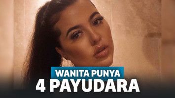 Tak Percaya Diri Punya 4 Payudara, Wanita Ini Akhrinya Jalani Operasi Pengangkatan