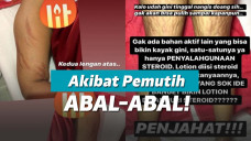 Pasien korban pemutih abal-abal