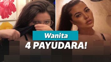 Wanita dengan empat payudara