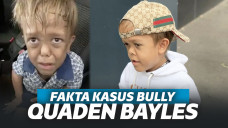 Disebut Penipu dan Cari Untung, Begini Fakta Quaden Bayles Bocah Yang Ingin Bunuh Diri Usai DIbully