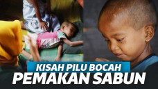 Tak Dipedulikan Ortu, 3 Bocah Ini Makan Sabun Selama 10 Tahun!