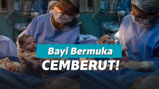 Bayi cemberut usai dilahirkan