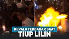 Tidak Hanya Lilin, Kepala Pemuda Ini Juga Ikut Terbakar di Hari Ulang Tahunnya