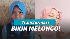 Transformasi wanita dari dekil jadi cantik