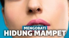 Cara Mengatasi Hidung Tersumbat