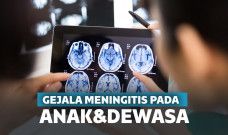 gejala meningitis
