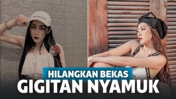 Selebgram ini suntik filler untuk hilangkan bekas gigitan nyamuk