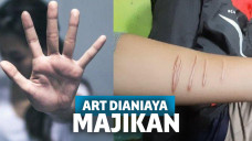 ART di Semarang dianiaya majikan