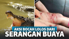 Mirip Adegan Film Aksi, Bocah 10 Lolos dari Kematian usai Pukul Buaya Tepat di Matanya