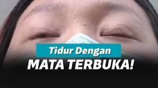 Operasi Plastik Gagal