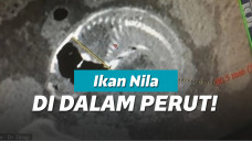 Seekor ikan nila ditemukan dalam organ tubuh pria di China