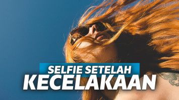 perempuan selfie setelah kecelakaan