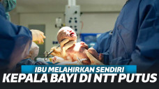 Ibu Melahirkan Sendiri, Bayi di NTT Tewas Kepalanya Putus Tertinggal Dalam Rahim