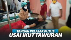 Ikut Tawuran, Tangan Pelajar Karawang Putus. Tertinggal di Jalan Saat Dibawa ke RS