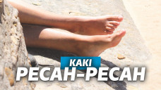 kaki pecah pecah