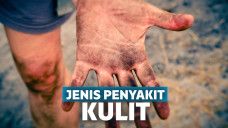Penyakit Kulit