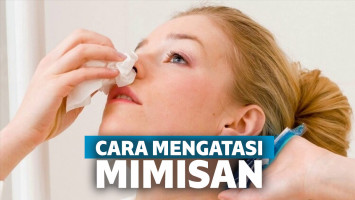 cara mengatasi mimisan