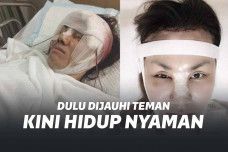 Proses operasi plastik Bow