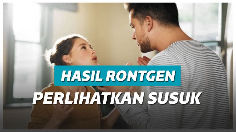 Ilustrasi suami istri berselisih