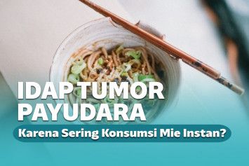 Ilustrasi mi instan