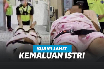 Kemaluan istri dijahit pakai kawat oleh suami karena dituduh selingkuh.