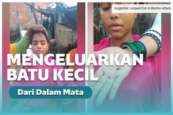 Gadis di India mengeluarkan batu-batu kecil dari matanya