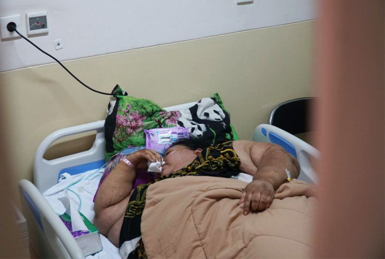 Sunarti Pasien Obesitas Meninggal