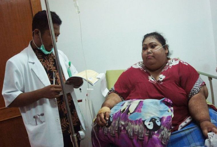 Sunarti Pasien Obesitas Meninggal