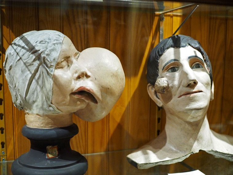 Mutter Museum