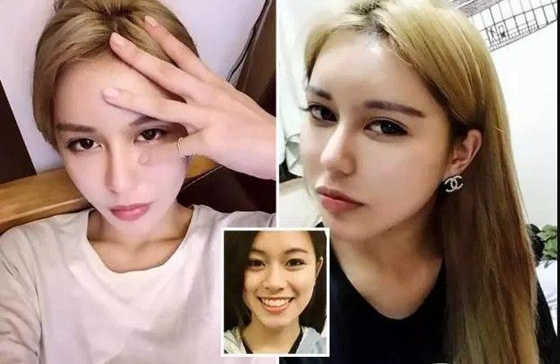 Oplas demi pacar