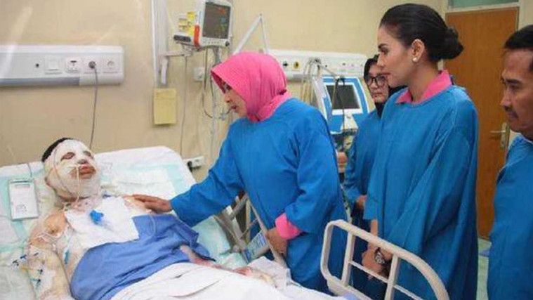 Ipda Erwin, Polisi Yang Dibakar Mahasiswa Meninggal Dunia