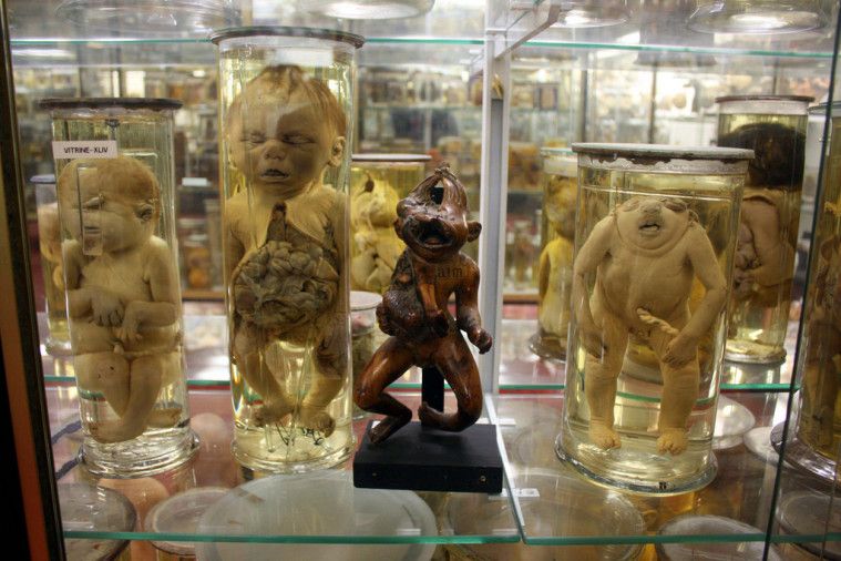 museum mengerikan