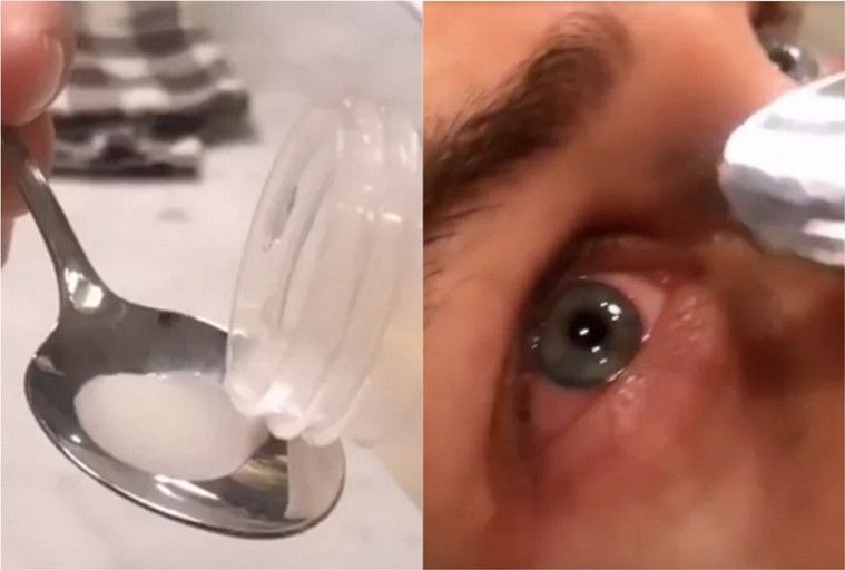 ASI dijadikan obat tetes mata