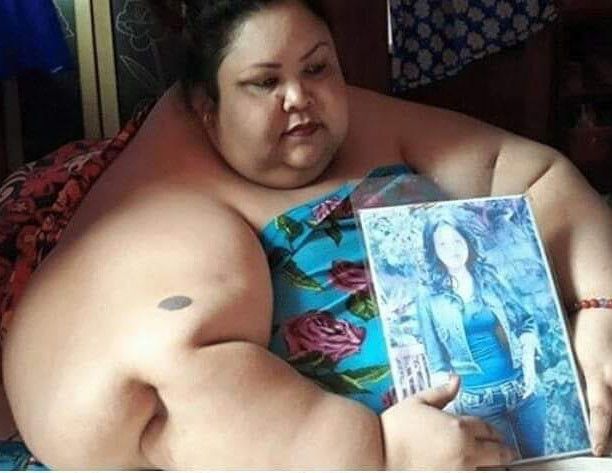Titi Wati Obesitas