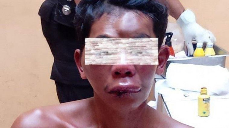Ilustrasi pengidap gangguan jiwa