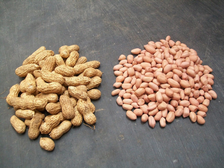 makanan penyebab jerawat