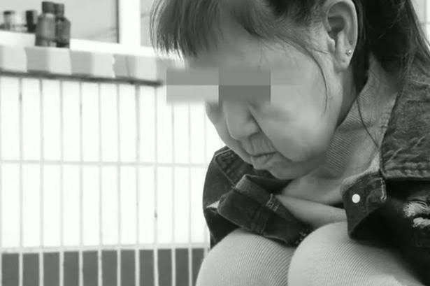 Xiaofeng, gadis yang menjadi sorotan media massa Cina karena operasi yang dijalaninya.