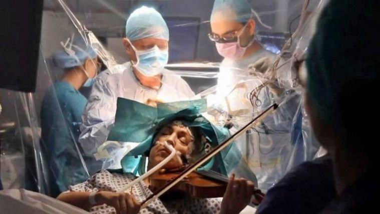 Wanita operasi otak sambil main biola