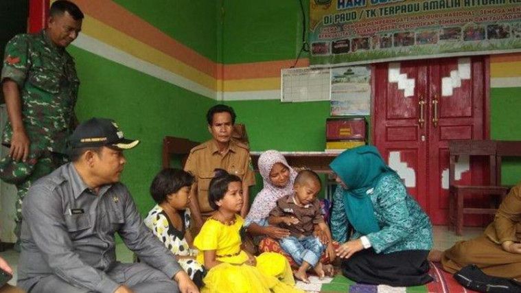 Tak Dipedulikan Ortu, 3 Bocah Ini Makan Sabun Selama 10 Tahun!
