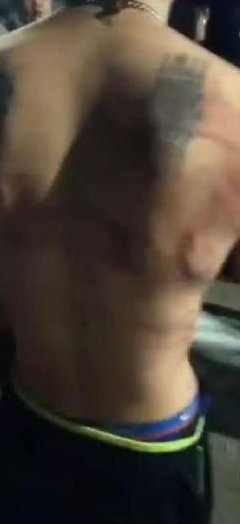 Dituduh Perkosa Gadis Remaja di Tempat Karaoke, Seorang Pria Dihajar Massa dan Dibakar Kemaluannya