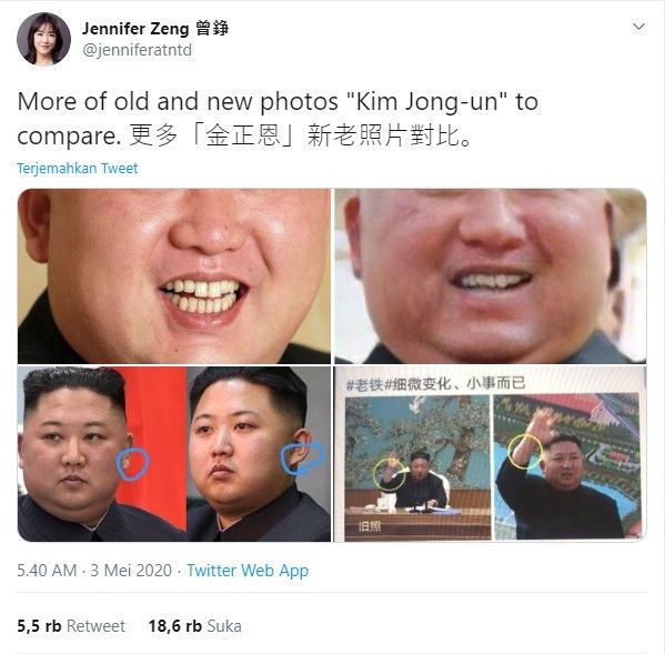 Sempat Menghilang, Heboh Kim Jong-un yang Sekarang Disebut Palsu. Gunakan Tubuh Ganda?